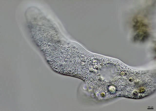 Amoeba leningradensis