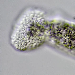 Amoeba leningradensis