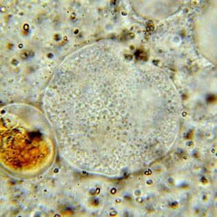 Amoeba proteus