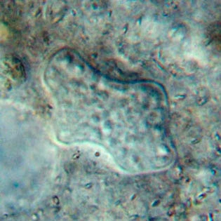 Amoeba proteis