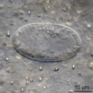 Amoeba proteus
