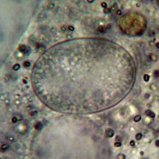 Amoeba proteus