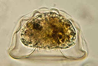 Arcella gibbosa