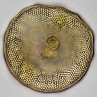 Arcella gibbosa Penard, 1890