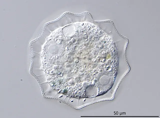 Arcella gibbosa Penard, 1890