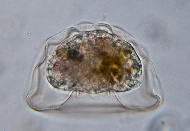 Arcella gibbosa Penard, 1890