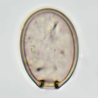 Cryptodifflugia oviformis