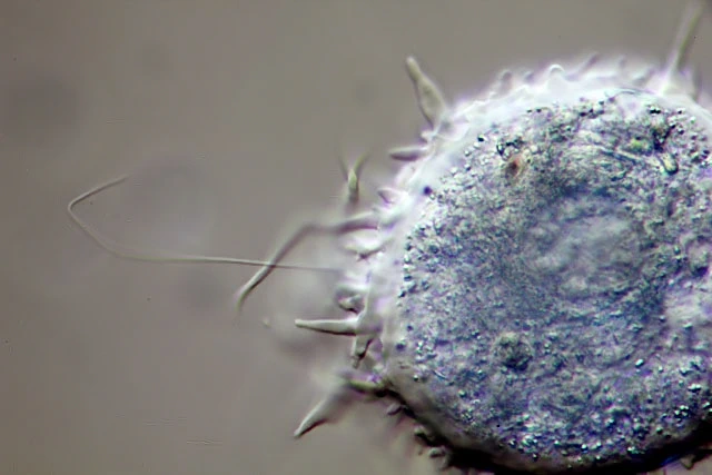 Dinamoeba mirabilis