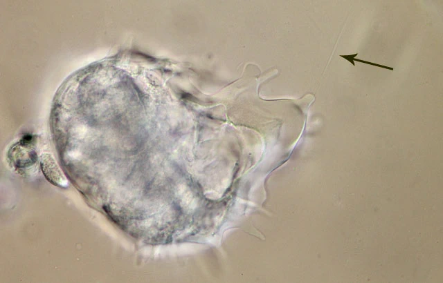Dinamoeba mirabilis