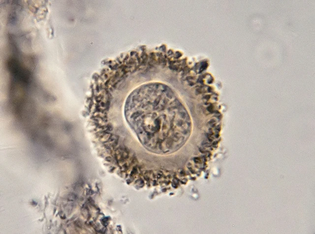 Frenzelina