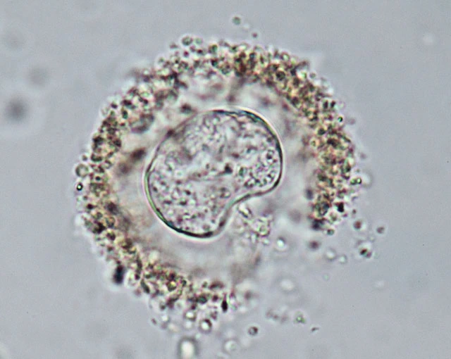 Frenzelina