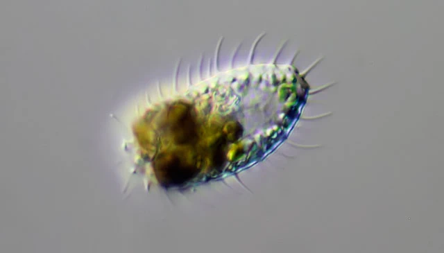 Lecythium spinosum with filopodia