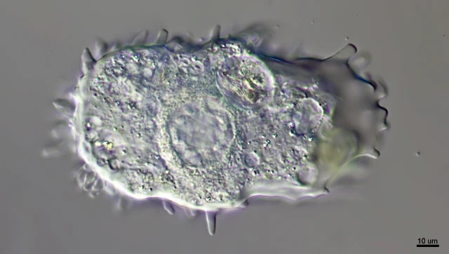 Mastigamoeba