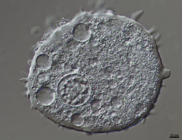 Mastigamoeba aspera