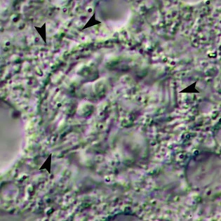 Mastigamoeba aspera