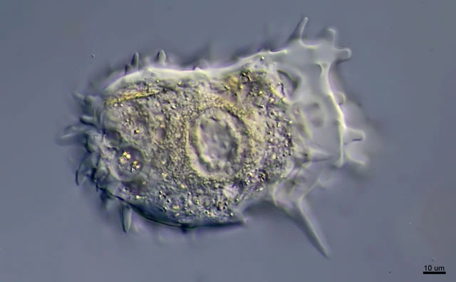 Mastigamoeba