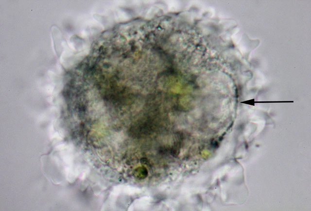 Mastigamoeba aspera