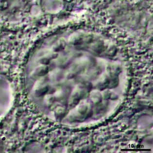 Mastigamoeba aspera nucleus=36um