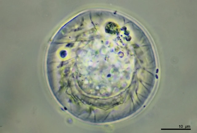 Microchlamys patella