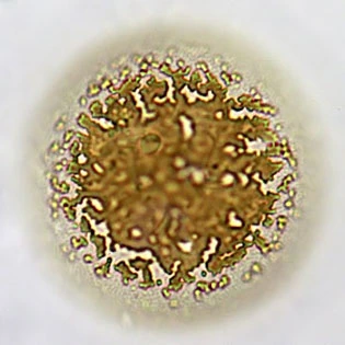 Microchlamys patella