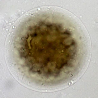 Microchlamys patella
