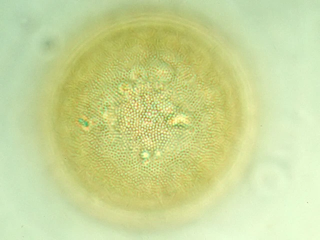 Microchlamys patella