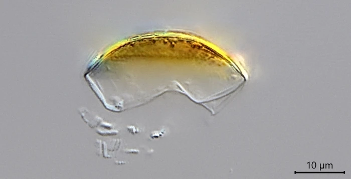 Microchlamys patella