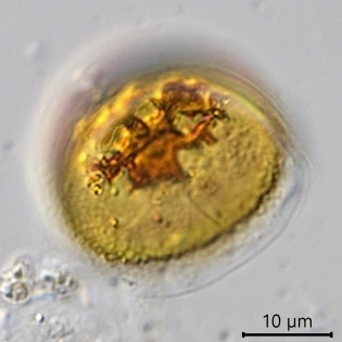 Microchlamys patella