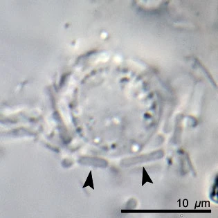Pelomyxa palustris