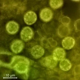 Pelomyxa palustris