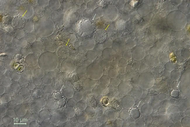 Pelomyxa palustris