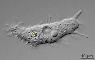 Acanthamoeba