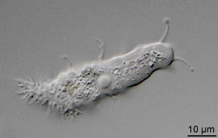 Acanthamoeba