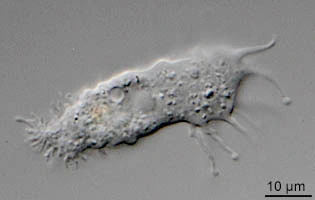 Acanthamoeba