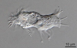 Acanthamoeba