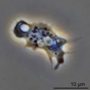 Acanthamoeba