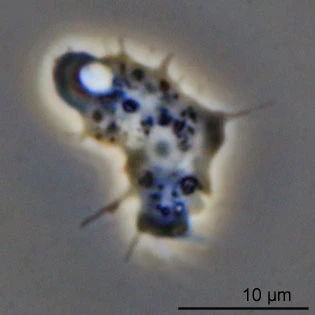 Acanthamoeba