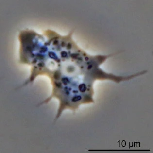 Acanthamoeba