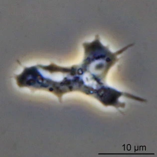 Acanthamoeba