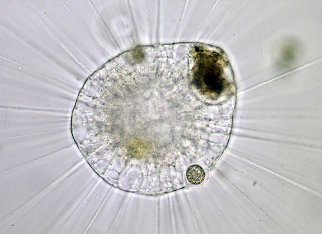 Actinosphaerium eichhornii