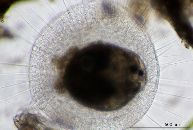 Actinosphaerium eichhornii