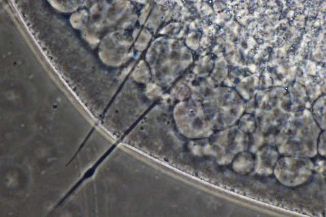 Actinosphaerium eichhornii