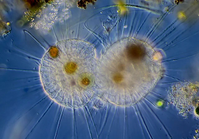 Actinosphaerium eichhornii