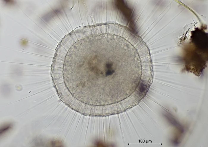 Actinosphaerium eichhornii