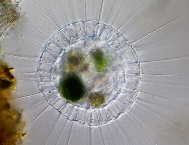 Actinosphaerium eichhornii