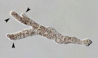 Amoeba pseudopodia