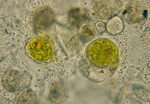Zonomyxa violacea