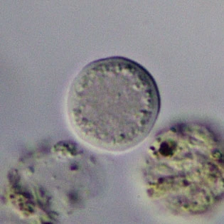 Zonomyxa violacea