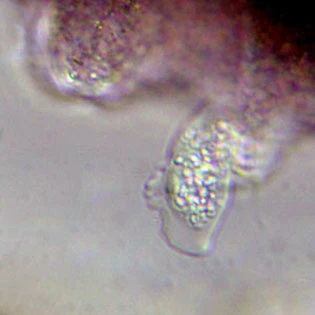 Amphizonella violacea