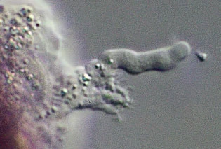 Zonomyxa violacea